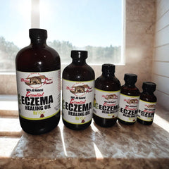 ECZEMA HEALING OIL